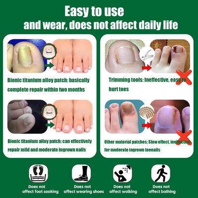 Titanium Ingrown Toenail Corrector,Nail repair tools,Ingrown Toenail Treatment,Suitable for most people with ingrown toenailsIngrown Toenail Removal Kit,- Designed for Ingrown Toenail Repair10pcs