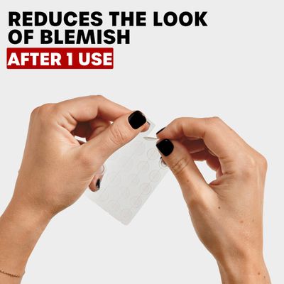 THAYERS Invisible S.O.S Hydrocolloid Acne Pimple Patch, Ultra-Thin Design Instantly Reduces Look of Blemishes, Set of 22 Pimple Patches