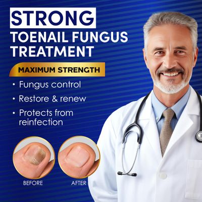 Toenail Fungus Treatment Extra Strength - Nail &amp; Toe Solution with Undecylenic Acid 25 and Tea Tree Oil