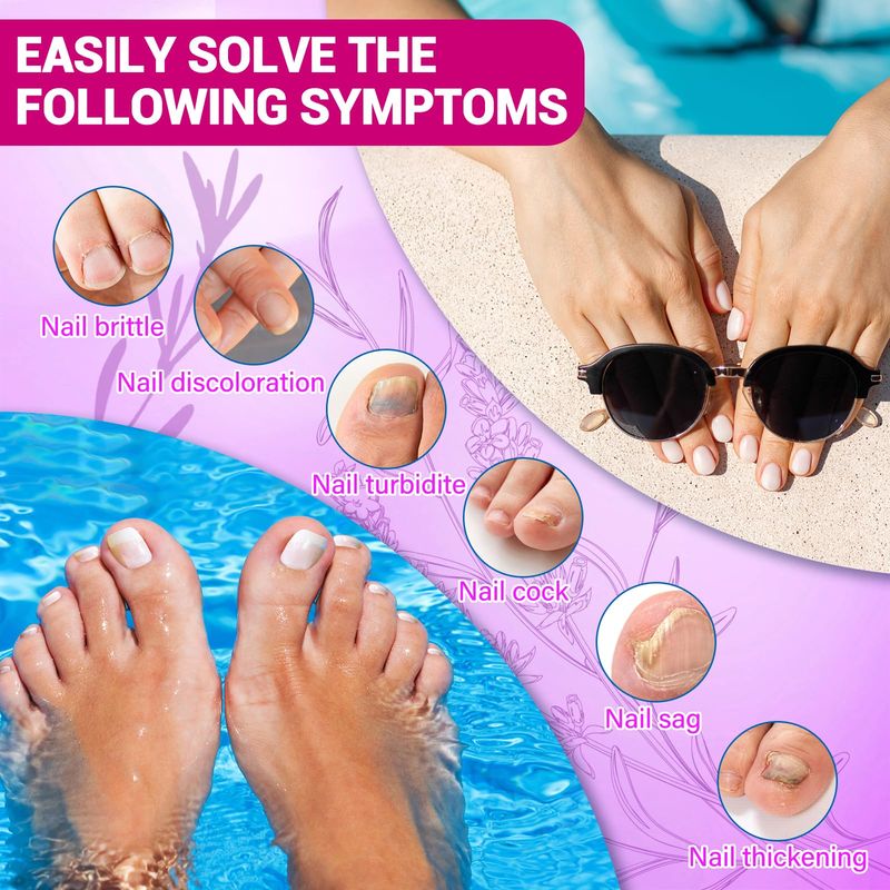 Toenail Fungus Treatment Extra Strength, Naturally &amp; Safely, Fungus Treatments Extra Strength for Thick, Broken, Discolored &amp; Damaged Nail