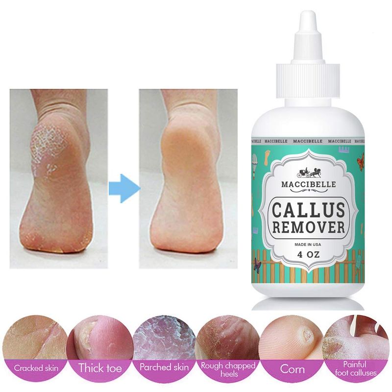Maccibelle Callus Remover EXTRA STRENGTH For Feet, Professional Callus and Corn Eliminator Liquid Gel 4 oz (1 Bottle)