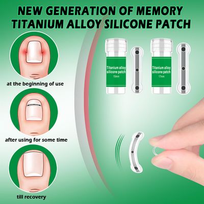 Titanium Alloy Silicone Ingrown Toenail Treatment, Designed for Curved Nail Repair, Ingrown Toenail Corrector, Nail correction tool, Ingrown Toenail Removal Kit,Suitable for Any Toenail Size men woman