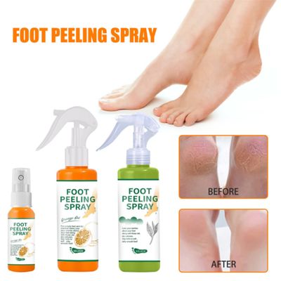 YG LianKai 2PCs Foot Peeling Spray Orange Oil,Foot Peeling Spray That Remove Dead Skin Within Seconds,Hydrating Nourish Peel Off Spray, Exfoliating Peeling & Calluses on Feet (30ml)