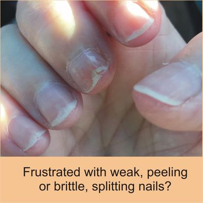 FlexiNail Fingernail Conditioner with FlexiNail Cuticle Conditioner for weak and peeling or brittle and cracking nails