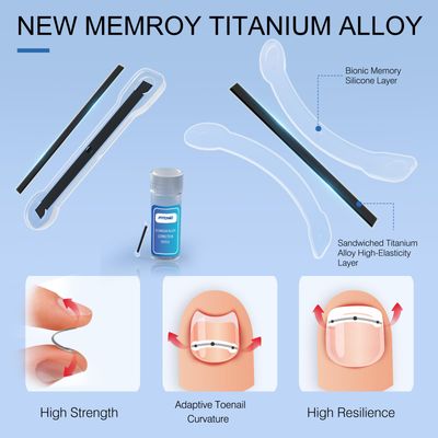 Titanium Alloy Ingrown Toenail Treatment, Ingrown Toenail Corrector for All Size Curve Correct Ingrown Toenail and Toenail Straightener of Big Toe