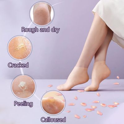 TEAWOO 5 Pairs Silicone Socks for Dry Cracked Feet, Womens Foot Socks for Moisturizing (Beige, Fits Up to Size 9)