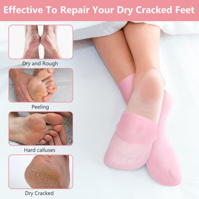Vigdit Silicone Socks for Dry Cracked Feet 2 Pairs,XL Moisturizing Socks Non-Slip Moisturizing Heel Socks for Dry Cracked Feet Women Ultra-high Stretch Foot Care Pedicure Socks for Men(Pink,XL)