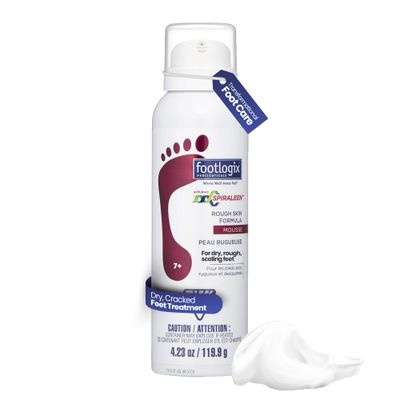 Footlogix Rough Skin Formula with Spiraleen - Mousse for Dry Cracked Heels and Feet, Foot Care for Men and Women, Dry Cracked Feet Treatment, 4.23oz