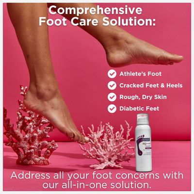 Footlogix Rough Skin Formula with Spiraleen - Mousse for Dry Cracked Heels and Feet, Foot Care for Men and Women, Dry Cracked Feet Treatment, 4.23oz