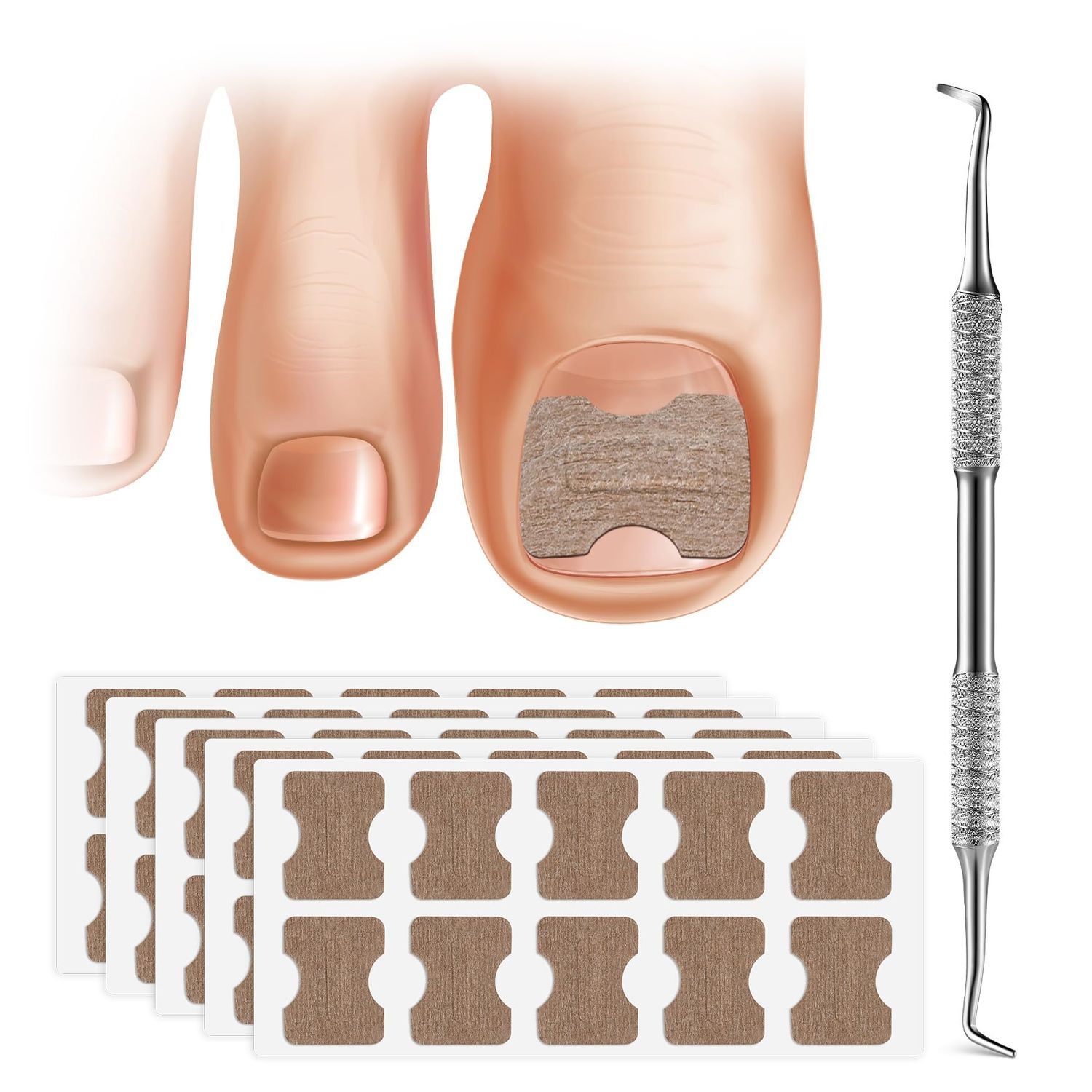 FERYES 50 PCS Breathable Ingrown Toenail Corrector Patch with Double-Ended Stainless Steel Toenail Lifter - Comprehensive Toenail Care Solution