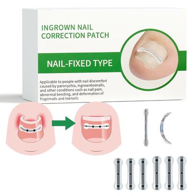 Titanium Alloy Ingrown Toenail Treatment, Ingrown Toenail Removal Kit for Curved Nail Repair, Nail Tools, Ingrown Nail Tool for Home Use (0.59/0.67in) SPYFAMILY 6
