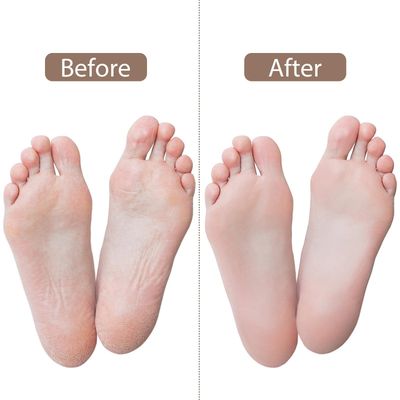 Tbestmax 12 Pcs Silicone Gel Socks for Dry Cracked Feet Heels Women - Day &amp; Night Socks - W4-10 | M5-8