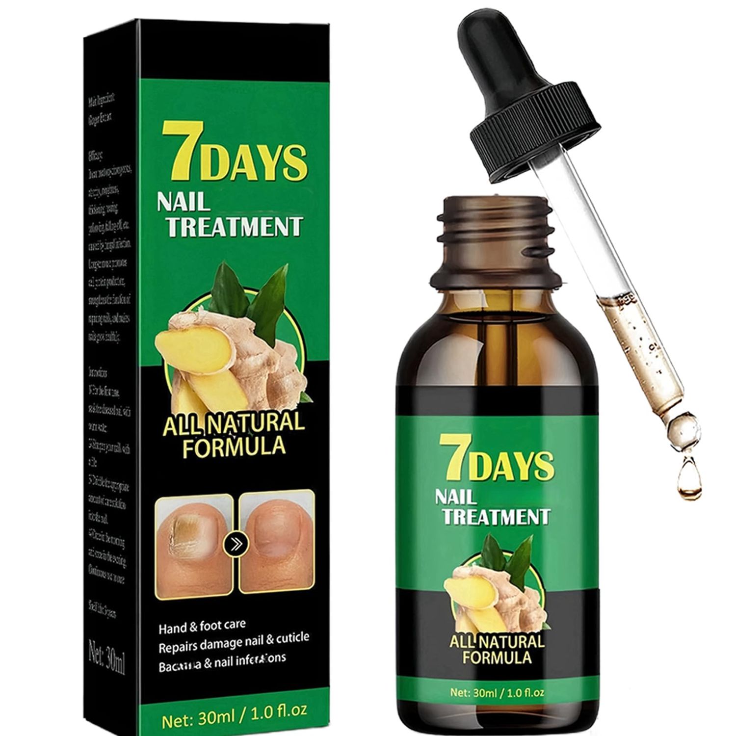 Ginger Nail Strengthener for Damaged Nails, 1Pc Treatment Oil, Ginger Nail Serum for Cracked Nails, Hand &amp; Foot Strengthener, Fingernail Repair for Split Toenail, 30ML