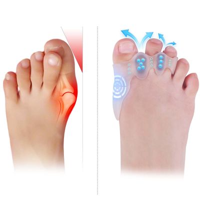 TEVEZO Toe Spacers &amp; Bunion Corrector for Kids | Toe Separators,Corn Callus Removers|Hammer Toe Straightener|Bunion Relief|Overlapping Toes Separators|Corn Pads for Toes|1 Pair (Small-Kids)