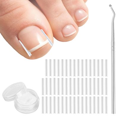 (501) Pcs Ingrown Toenail Corrector Treatment Set, Professional Pain-Free Ingrown Toenail Removal Kit with Toenail Lifter, Easy Fixed Ingrown Toenail Tool, Toenail Straightener Strip for Men Women