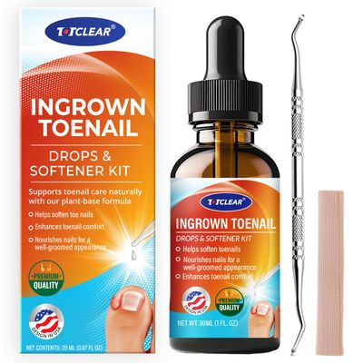 Ingrown Toenail Relief: Ingrown Toenail Tool for Men Women - Ingrown Toenail Removal Kit - Ingrown Toenail Corrector Drops - Ingrown Toenail Removal - Effective Solution for Ingrown Toenails - 30ml