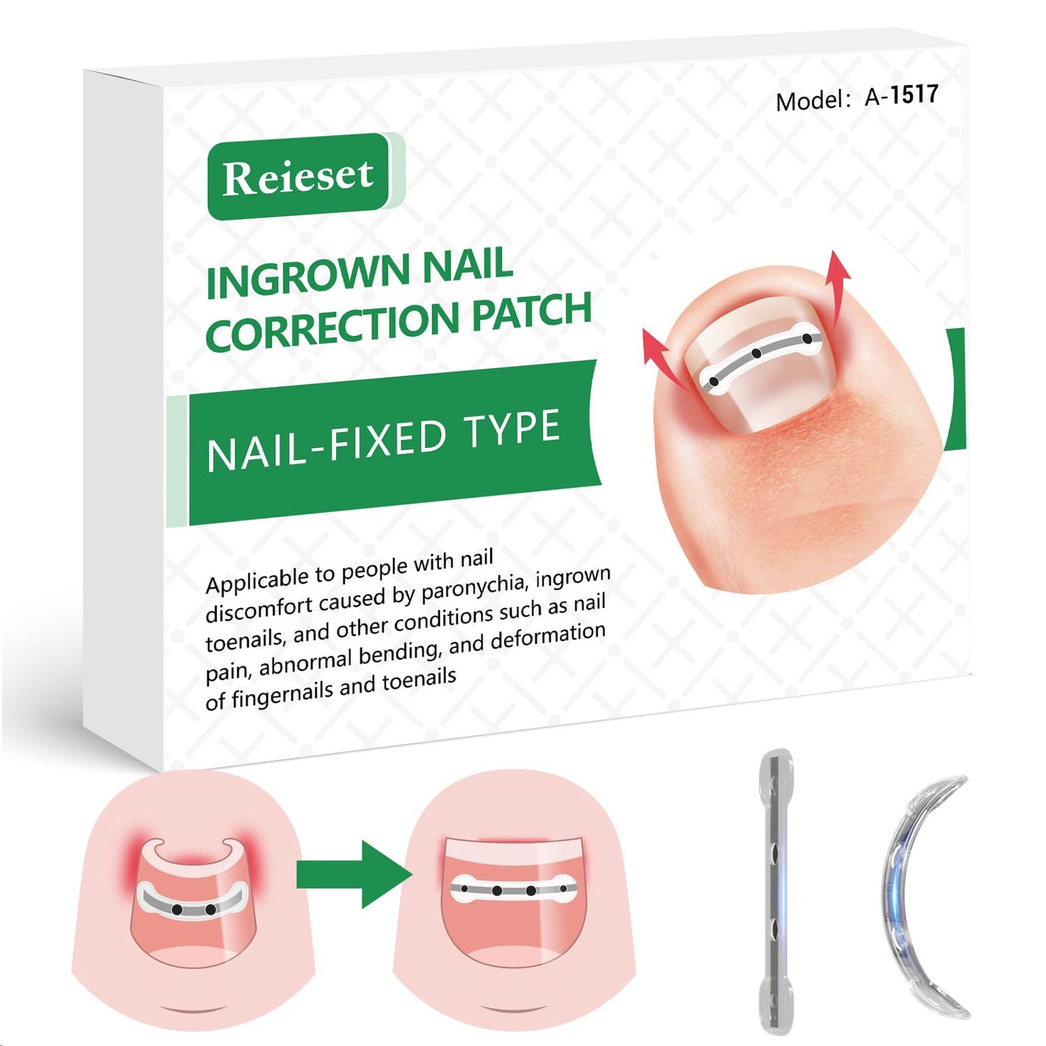 Reieset Titanium Alloy Ingrown Toenail Treatment, Nail Tools, and Ingrown Toenail Removal Kit Specially Designed for Curved Nail Repair and Ingrown Toenail Corrector(0.59/0.67in)