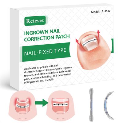 Reieset Titanium Alloy Ingrown Toenail Treatment, Nail Tools, and Ingrown Toenail Removal Kit Specially Designed for Curved Nail Repair and Ingrown Toenail Corrector(0.59/0.67in)