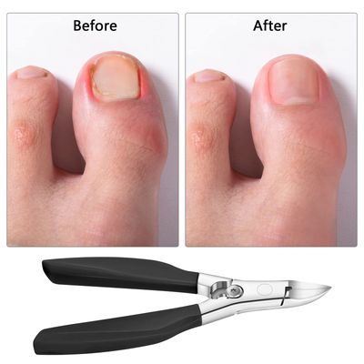 Podiatrist Toenail Nipper,Heavy Duty Nail Clippers for Thick &amp; Ingrown Toenails,Toenail Clipper Trimmer for Seniors Pedicure,Stainless Steel Sharp Blades,Long Handle,&amp; Lock(Black)
