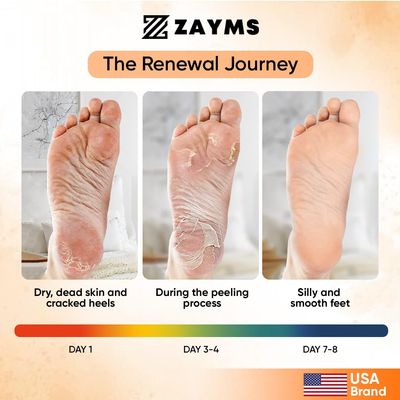 ZAYMS Foot Peeling Mask 5 Pack - Exfoliating Mask for Baby Soft Feet, Removes Dead Skin &amp; Calluses, Repairs Cracked Heels, Natural Peel for Smooth, Soft Feet