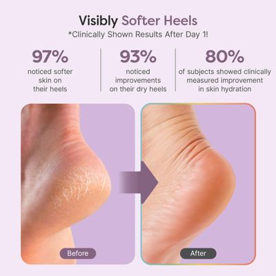 ZenToes Natural Foot Balm | Hydrating Cream for Dry, Cracked Heels &amp; Feet | Enriched with Coconut, Tea Tree, Jojoba &amp; Vitamin E Oils | Soothes &amp; Softens Rough Skin | 2oz