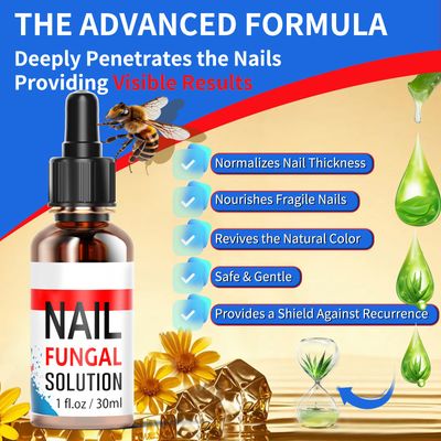 Toenail Fungus Treatment, Fingernails, Extra Strength Effective Enhancing Nail Repair for Finger - 30ML Safely &amp; Gently Nail Repair, Softener