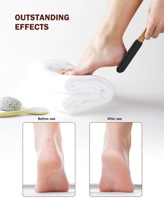 BEZOX Foot Pumice Stone Pedicure File(1 PCS) - Wooden Handle Foot File Callus Remover for Smoother Feet and Hands - Foot Scrubber, Heel Sander and Dead Skin Scraper - Black