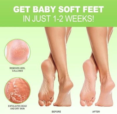 JVR Foot Peel Mask - 3 Pairs - Exfoliating Peeling Callus Remover, Repairs Cracked Heels &amp; Dry Skin, for Smoother and Softer Feet (Aloe Vera)