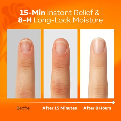 modelones Cuticle Oil Pen Rose Nail Oil for Growth and Strength Nail Growth Oil Cuticle Softener Quick Dry Nail Care Moisturize and Strengthen Damaged Nails 15ml 0.5Fl Oz