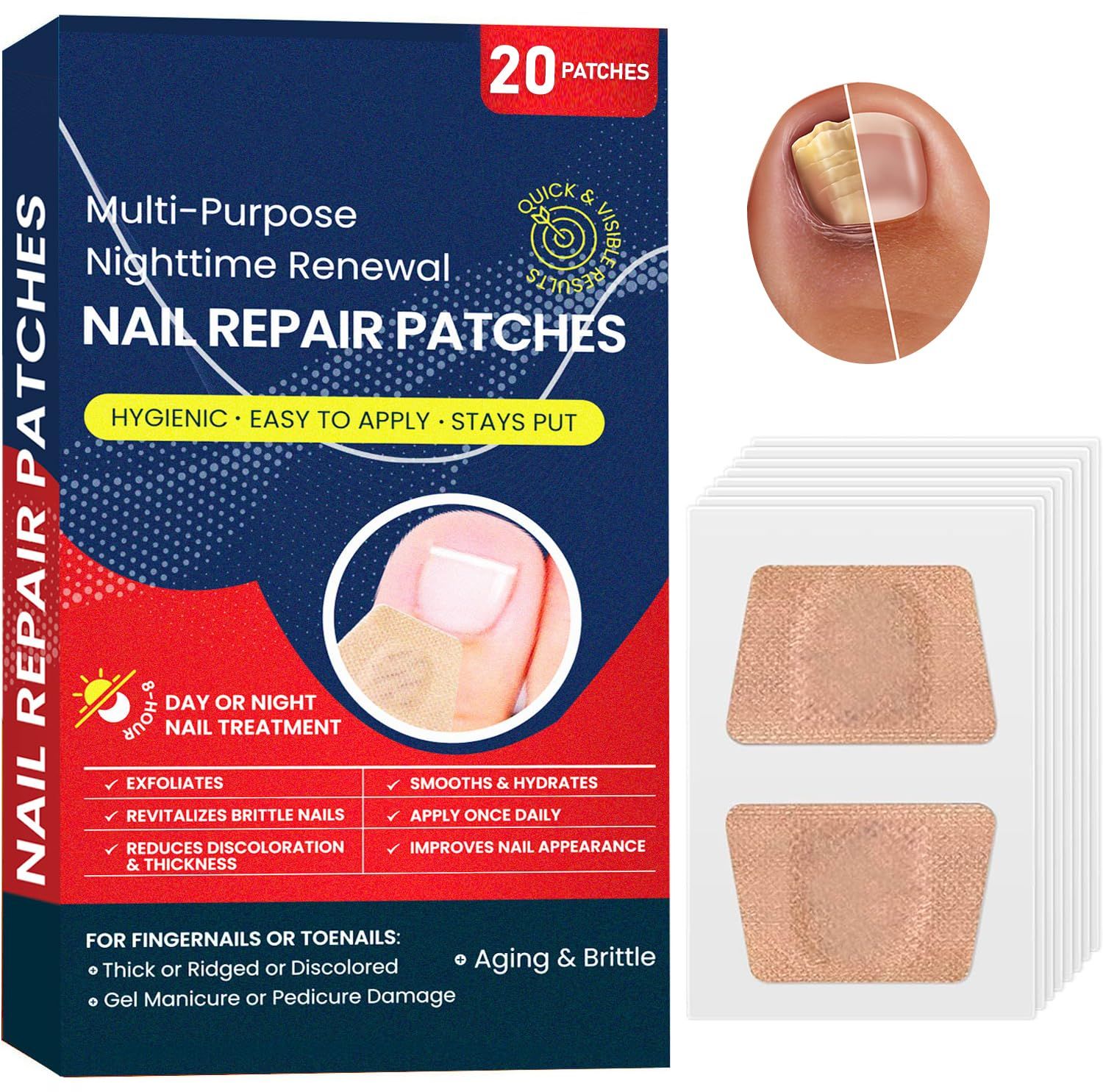 Toenail Fungus Treatment for Nail Repair: Nail Fungus Treatment Extra Strength - Toe Nail Fungus Treatments Fungus Nail Treatment for Toenail and Fingernail - Nighttime Renewal Fungal Nail Patches