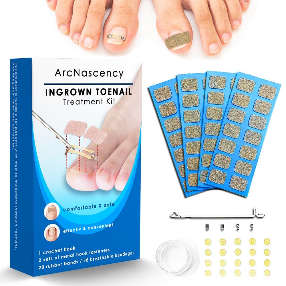 ArcNascency Ingrown Toenail Treatment Kit - 56 Adhesive Strips, 20 Rubber Bands, 4 Stainless Steel Clips for Effective Home Toenail Corrector