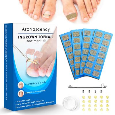 ArcNascency Ingrown Toenail Treatment Kit - 56 Adhesive Strips, 20 Rubber Bands, 4 Stainless Steel Clips for Effective Home Toenail Corrector