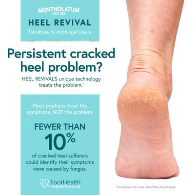 Mentholatum Heel Revival, Persistent Cracked Heel Repair Treatment, 1 Tolnaftate Antifungal Cream, Antifungal Foot Treatment, Eliminates &amp; Prevents Fungus, 1 OZ