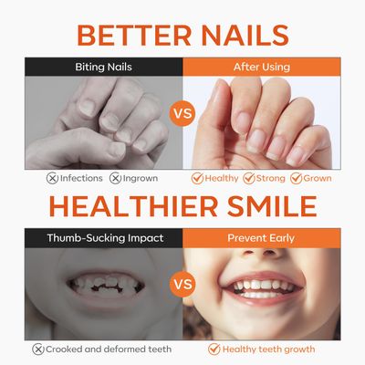 modelones Nail Biting Treatment for Kids Thumb Sucking Deterrent Quick Dry Nail Biting Prevention Bitter No Bite Nail Polish for Nail Care Stop Biting Nails Repair for Damaged Nails 0.34 fl oz