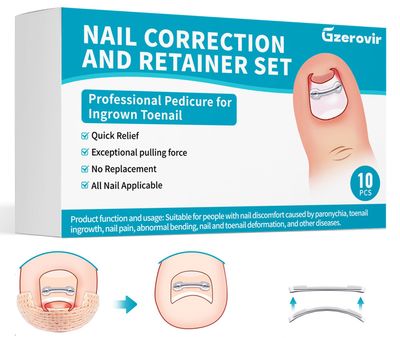 Titanium Alloy Ingrown Toenail Treatment - Professional At-Home Ingrown Toenail Corrector for All Size Curve Correct, Ingrown Toenail Removal Kit for Pain Relief with Toenail Corrector Patch