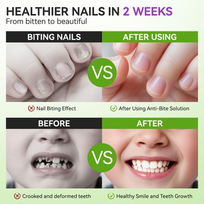 Stop Biting Nail Pen for Kids 2-9 - Gelike EC Bitter Taste Treatment for Thumb Sucking Deterrent - Easy and Quickly Stop Nail-biting Habit with Safe Solution