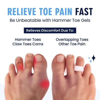 Dr. Fredericks Original Hammer Toe Gels - 2 Pairs - Hammertoe Support Crest for Women & Men - Cushion & Temporary Splint for Toe Alignment, Crooked Toes, and Pain Relief - White - 1 Loop Design