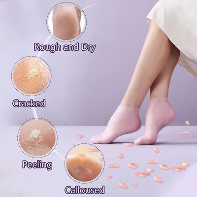 TEAWOO 4 Pairs Silicone Socks Gloves Set for Dry Cracked Feet and Hands, Silicone Foot Socks for Women, Moisturizing Feet