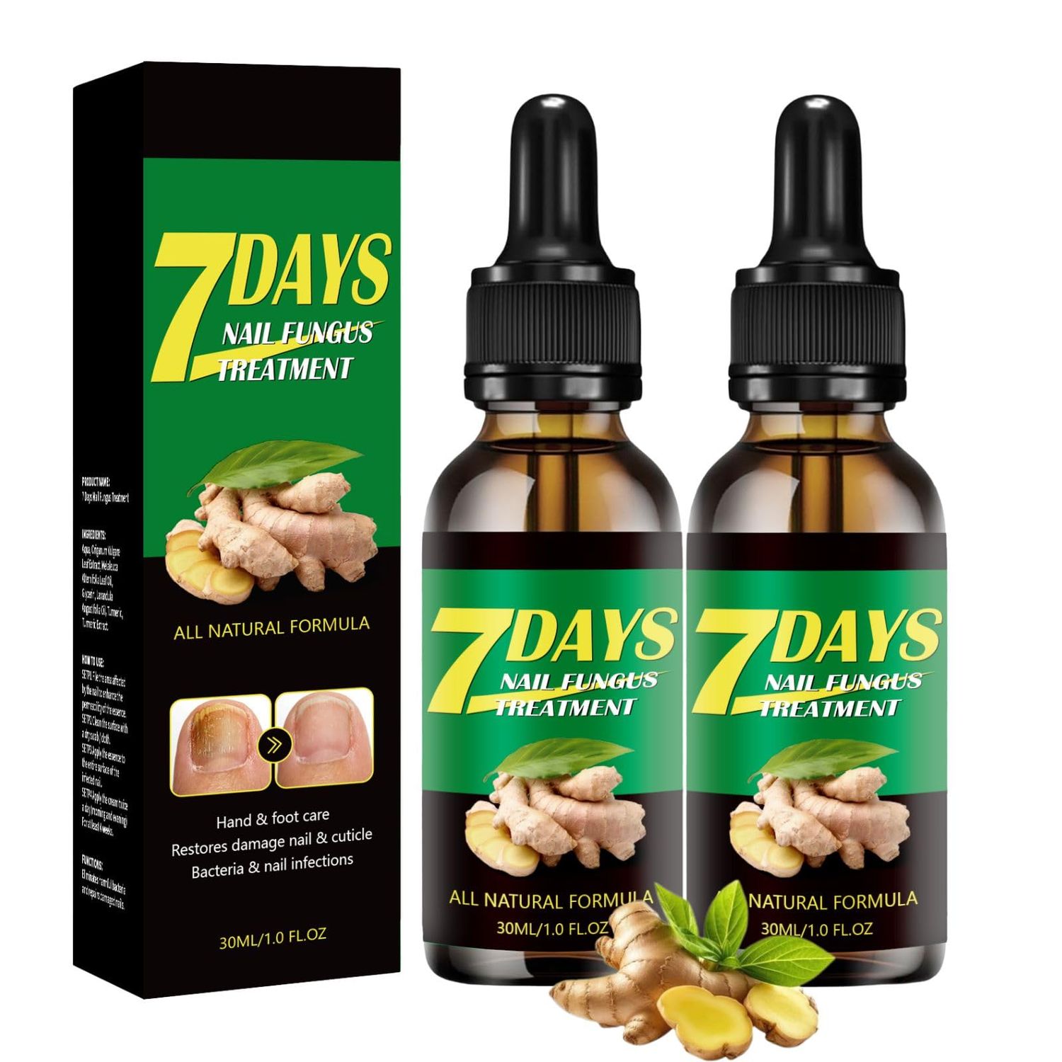 2PCS Ginger Nail Treatment, Ginger Cuticle Care Oil for Nails, Multi-Purpose Nail Repair Nutrient Oil (01)