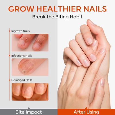 modelones Nail Biting Treatment, No Bite Nail Polish, Thumb Sucking Deterrent, Promotes Fast Nail Growth, Stop Nail Biting, Easy Application, Quick-Drying Bitter Nail Polish 0.5 Fl Oz
