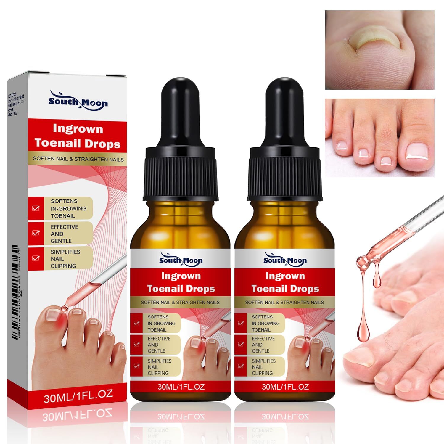 2PCS Ingrown toenail drops,Ingrown Toenail Relief,Easy Trim Ingrown Toenail Tools,Toenail Fluid With Silicone Gel Toe Caps Essential Oil Diffuser,Ingrown Toenail Reliever and Softener Kit