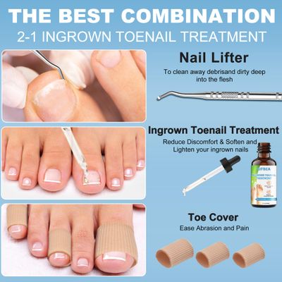 Ingrown Toenail Treatment w/Ingrown Toenail Drops Reliever &amp; Softener,Double Sided Pedicure Nail Lifter Tool for Easy Trimming Care Thick Nail &amp; Ingrown Toe Nail,Toenail Cleaner Kit for Men Women