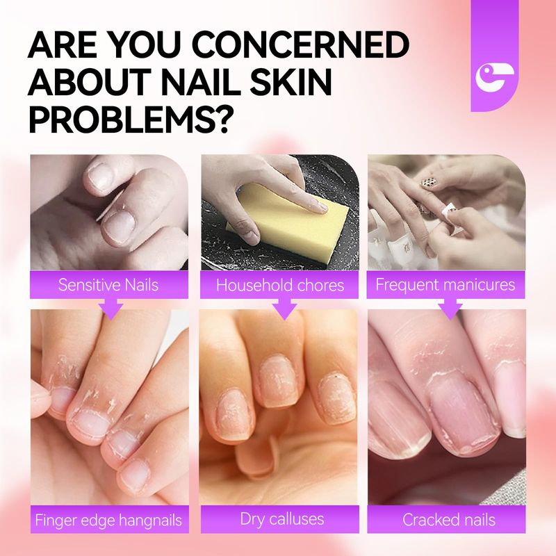 Gelike EC Cuticle Remover Cream Softener - Rose Fragrance Nail Care for Women - Intensive Hydration for Rough Cuticles - Cruelty-Free Moisturizing Formula