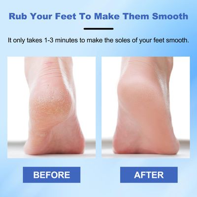 Veinsgrain Foot File, Veins Grain Foot File, Foot File Callus Remover, Nano Glass Foot File with Non-Slip Ergonomic Handle, Pedicure Tool for Smooth Feet, Safely Removes Hard and Dead Skin (2 Pcs)