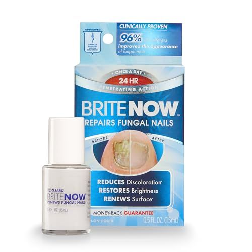 ProClearz Brite Now Nail Treatment, Restores The Appearance Of Damaged &amp; Discolored Nails, Peel-Away Technology, Brightening &amp; Smoothing Nail Repair, 0.5 Ounce