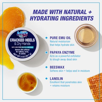 Blue Goo CRACKED HEELS &amp; DRY HANDS Skin Softener for Dry Feet, Hands, Hydrating and Smoothing, Moisturizer, Dryness Relief, 2 Ounce, made with 100 PURE EMU OIL