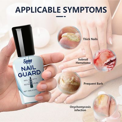 YFKEJI Onyxoguard Nail Growth And Repair Serum, Nail Growth and Strengthener Essence For Thin Nails And Growth, Nail Growth Serum, Onyxoguard Serum (2PCS), White