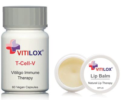 Vitiligo Vitilox Lip Balm and T-Cell-V Immune Therapy Capsules