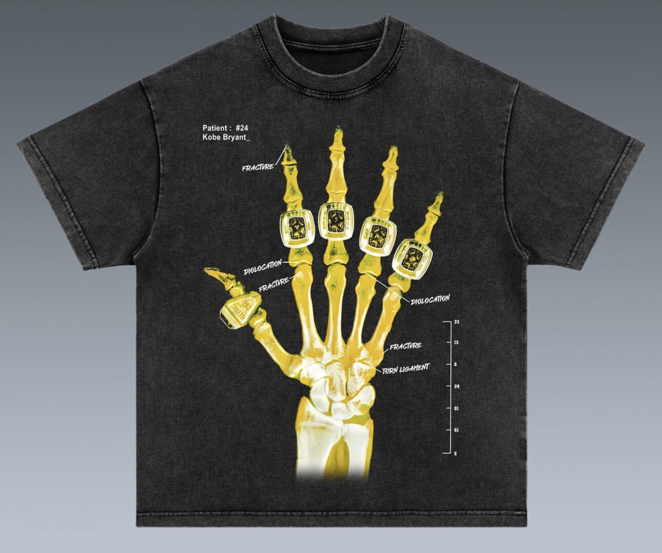 Kobe X-Ray