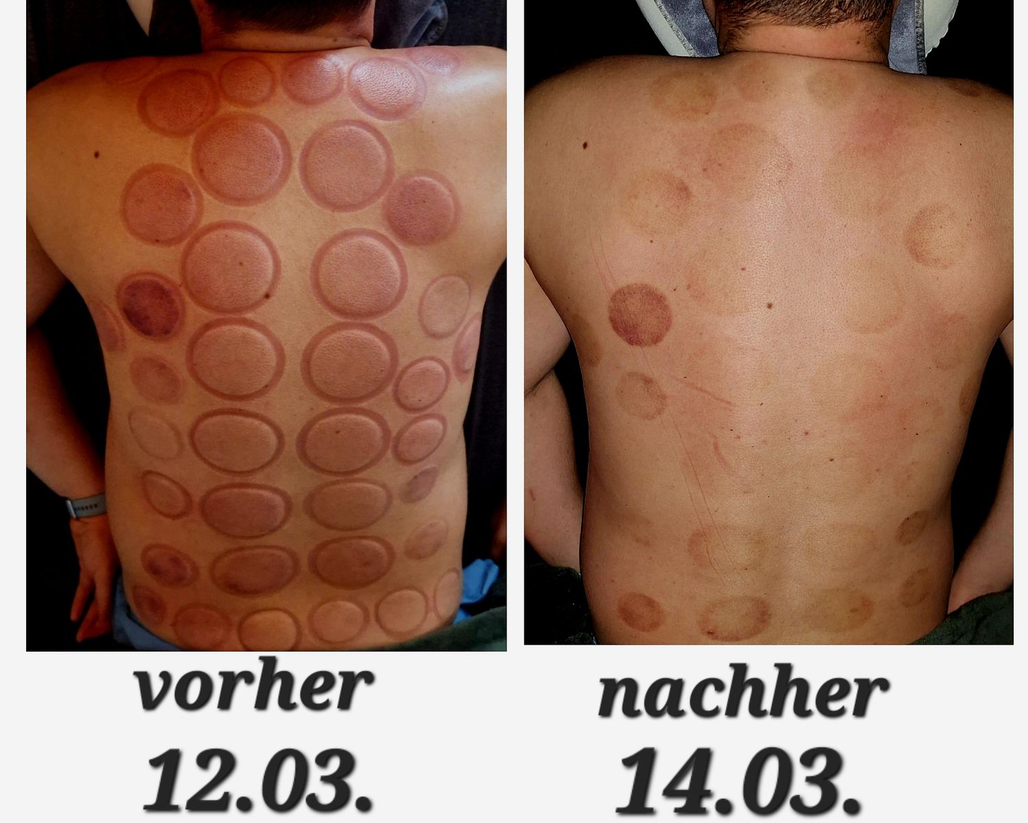 Praxis Alberg® – CupCellSystem® Schröpfmassage neu gedacht Entlastend. Aktivierend. Zellorientiert. Traditionell.